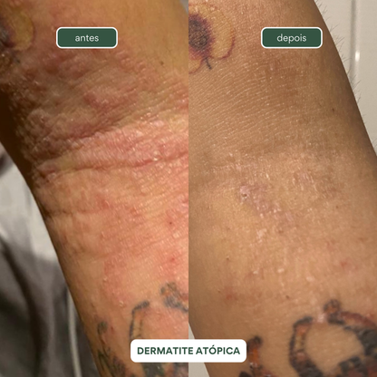 Por categoriaHidrataçãoLimpezaTonificaçãoCuidados especiais e MáscaraEsfoliaçãoBarbear Shampoos e Condicionadores
Nutrição e finalizaçãoSabonetes e esfoliantesHidrataçãoDesodorantesPor NecessidadePele maduraPele oleosaPele secaPele com manchasPele sensíve
